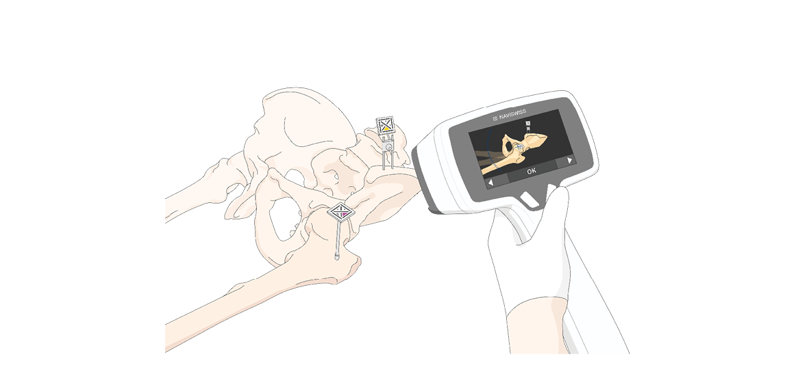 Assistive technology