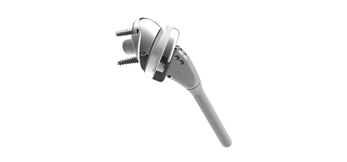 Shoulder replacement solutions